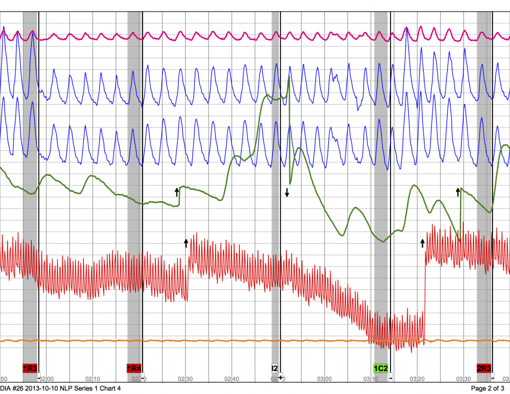 Series 1 Chart 4 - DIA #26 2013-10-10 NLP p.2