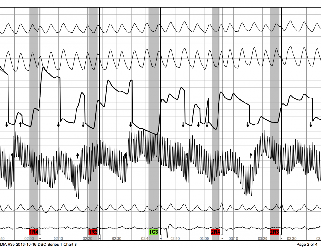Series 1 Chart 8 - DIA #35 2013-10-16 DSC p.2
