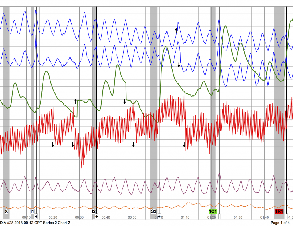 Series 2 Chart 2 - DIA #28 2013-09-12 GPT p.1
