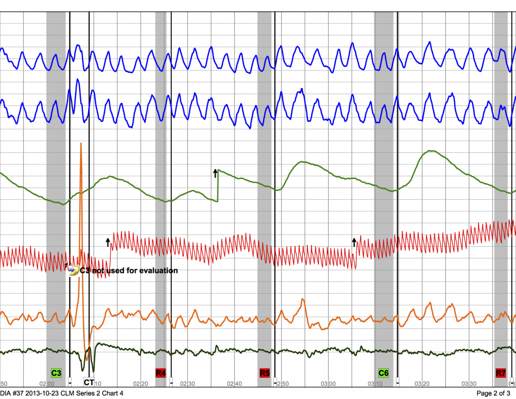 Series 2 Chart 4 - DIA #37 2013-10-23 CLM