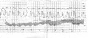 “Green River Killer” Gary Leon Ridgway’s Polygraph Charts ...
